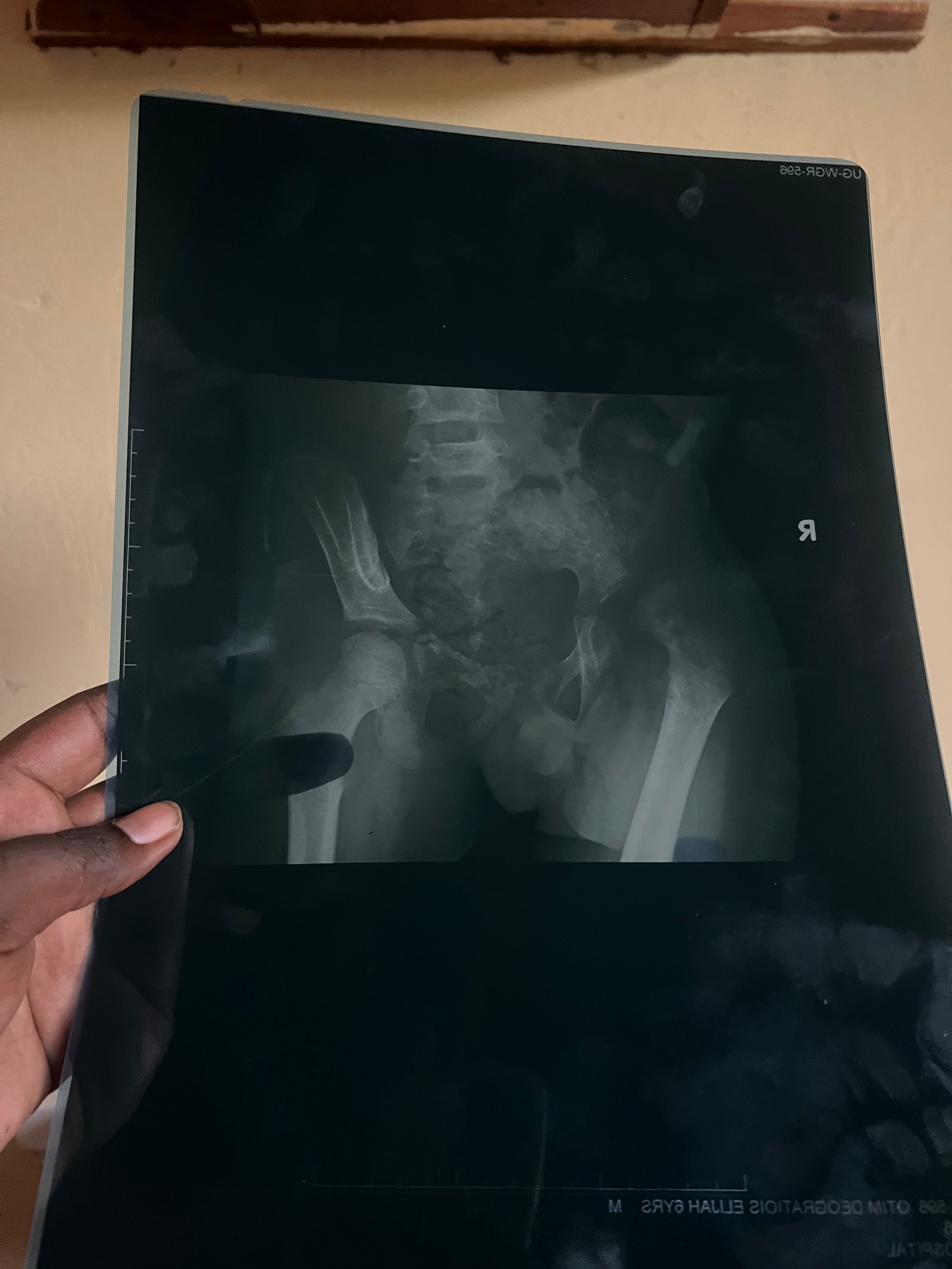 Story image
